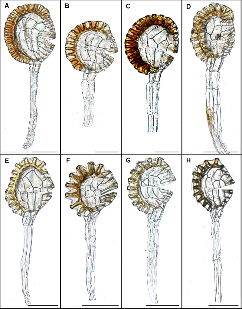蕨孢子囊群横切结构图图片
