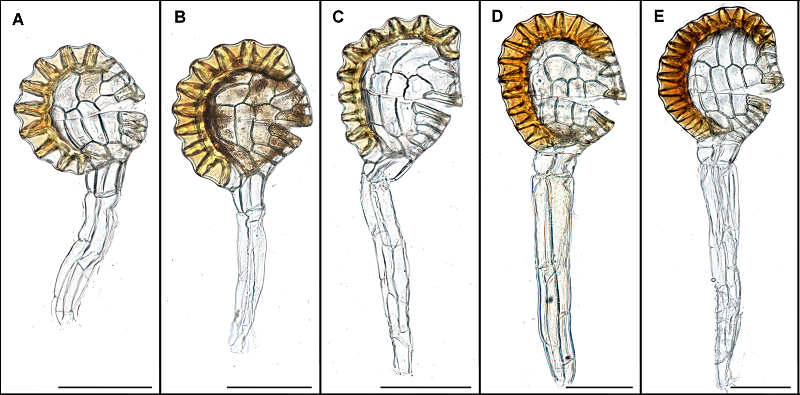 蕨孢子囊群横切结构图图片